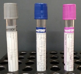 CMV IGRA assay specific tubes Please contact Immunology for details