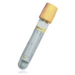 ENA Antibody (Extractable Nuclear Antigens): RO (SS-A)